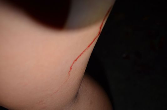 my leg bleeding after a leech in Taman Negara in Malaysia