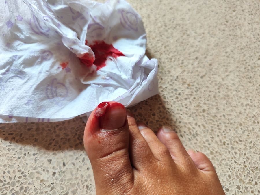 challenging 2024 year - injured in Kenya